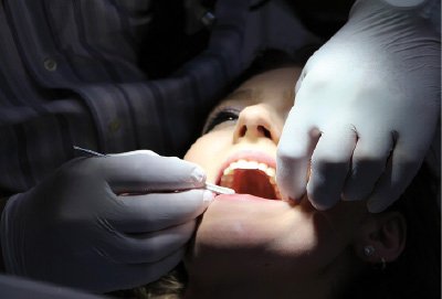 Dientes en el día en Quintana