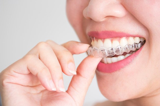 Invisalign en Quintana, Ventas y Ciudad Lineal