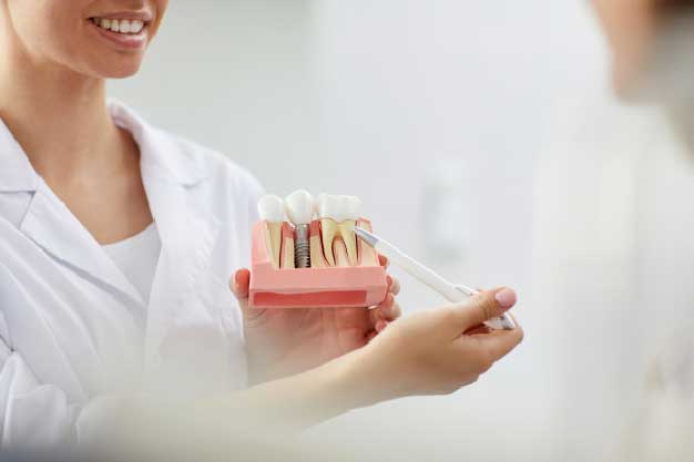 Implantes dentales con poco hueso en Quintana, Ventas y Ciudad Lineal