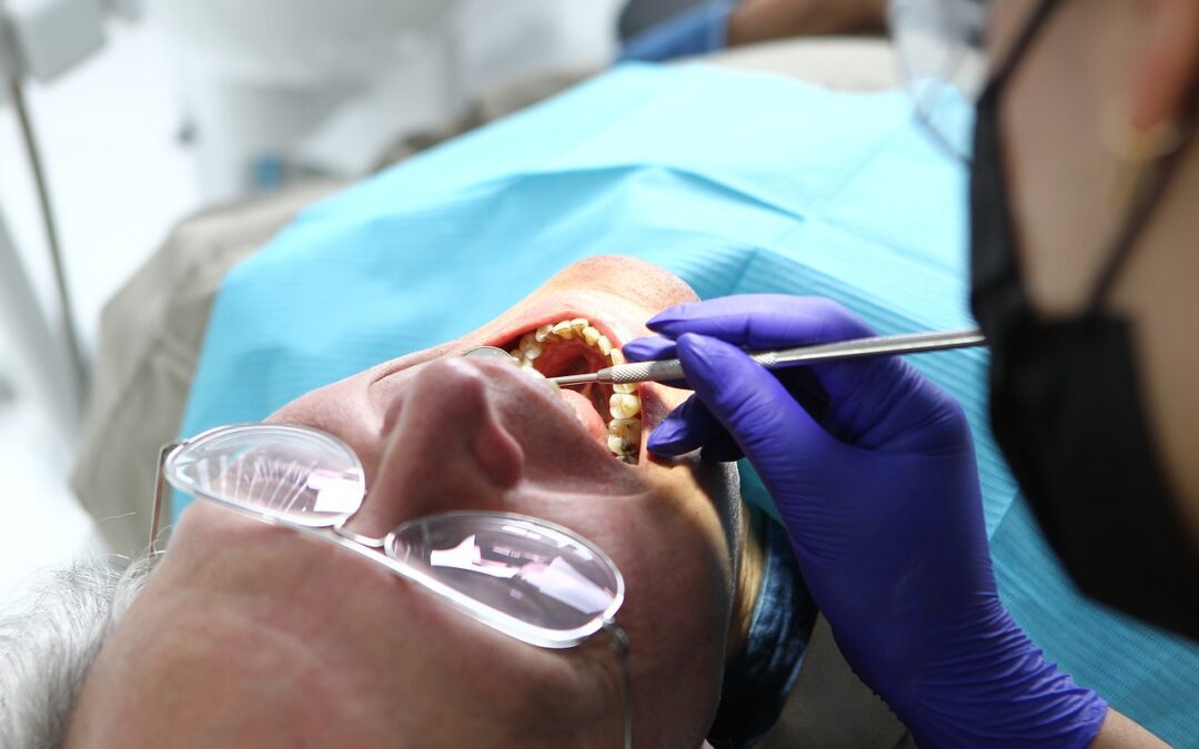 La solución para los dientes amarillos, ¿blanqueamiento o carillas?