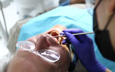 La solución para los dientes amarillos, ¿blanqueamiento o carillas?