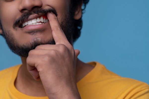 Periodontitis
