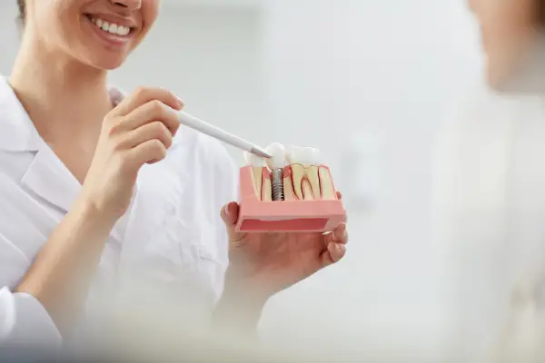 Tiempo entre extracción e implante dental: qué conviene esperar